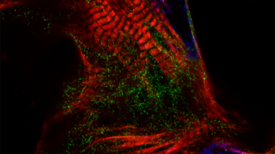 A fluorescent image of heart cells was taken by 3rd year Exeter medical student Carla Handford